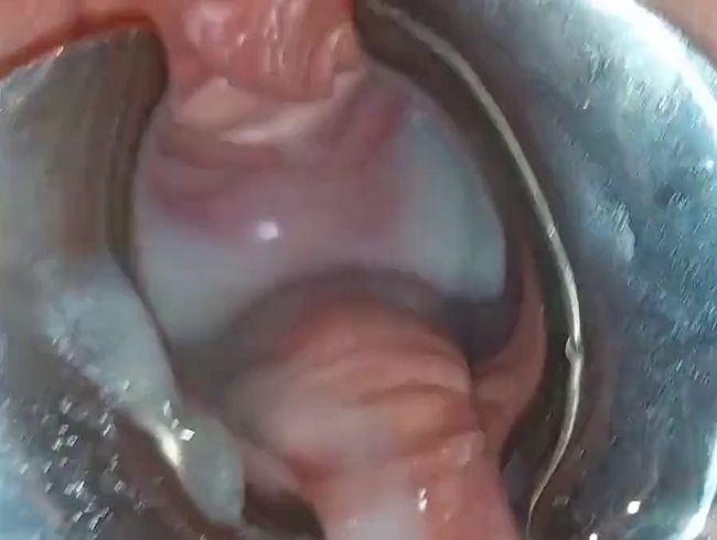 Riesige Sperma Ladung direkt in meine Fotze durch das Spekulum